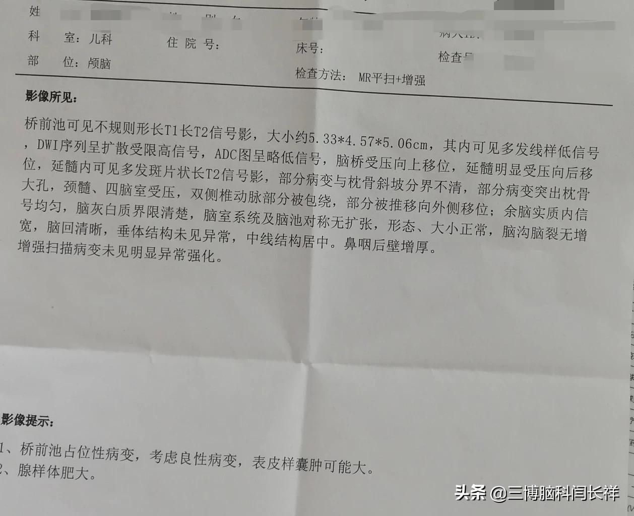 在生长发育期的儿童,缺钙主要引起 o型腿 ,x型腿,肋骨串珠,出汗等