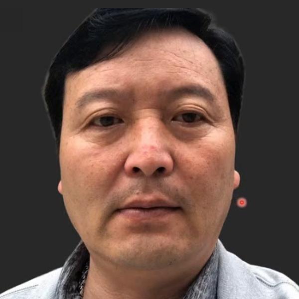 面相山根在哪里_山根面相学