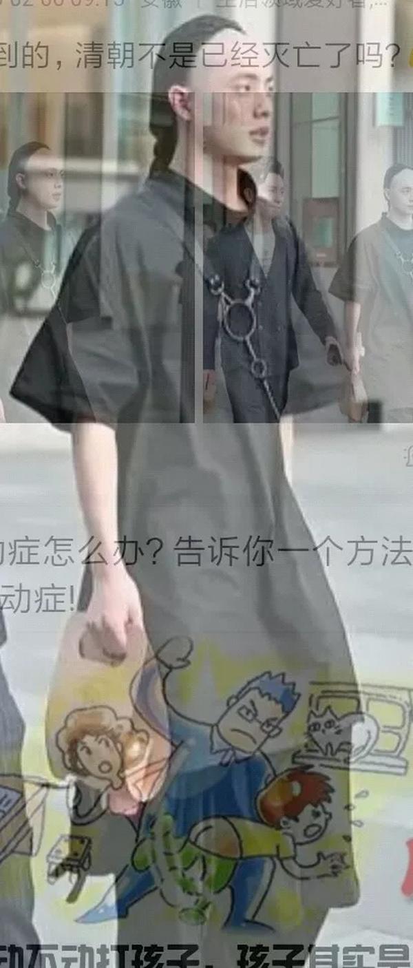 年轻秃头的正确发型 男士（年轻秃头的正确发型 男士短发）