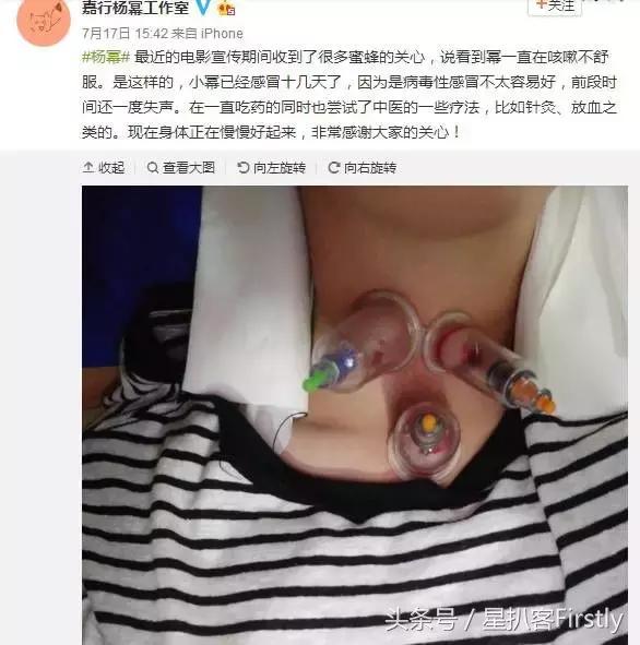 杨幂的泡脚，刘诗诗的刮痧，娱乐圈有哪些奇葩的养生大法