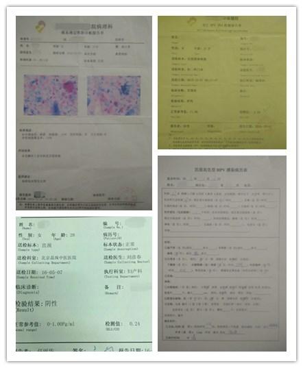 HPV感染后的常见症状