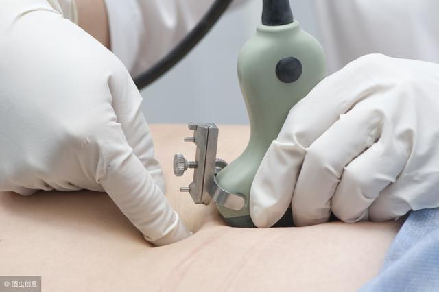 甲减、甲亢、甲状腺炎，哪些情况需甲状腺穿刺活检？