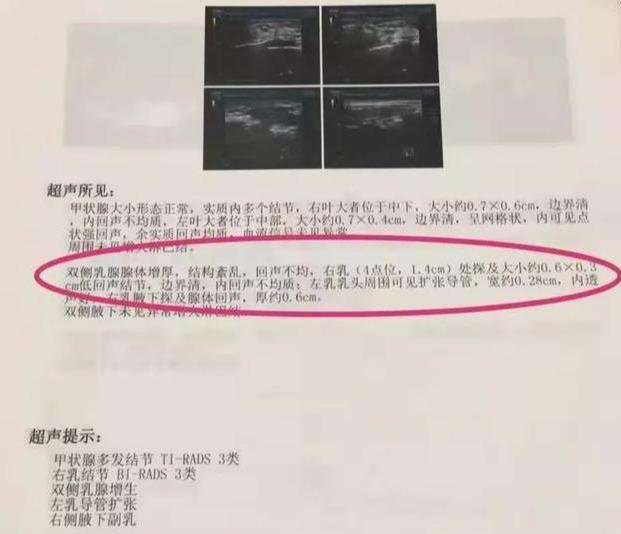 乳头雌化是什么意思(男生胸雌化)