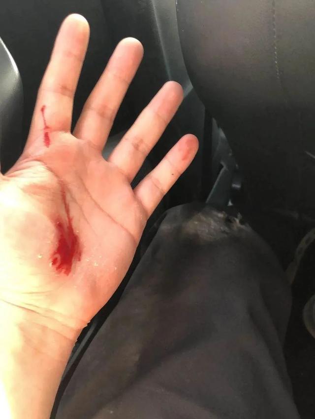 五一特刊 | 有一种手，叫龙城警察的手