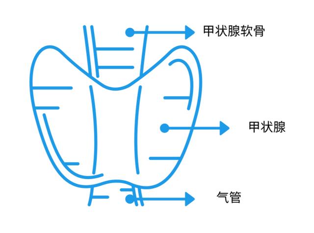 体检查出「甲状腺囊肿」该怎么办？这种病严重吗？