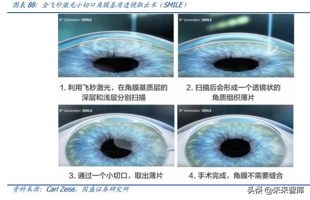 爱博医疗深度解析：专注创新的眼科器械龙头企业