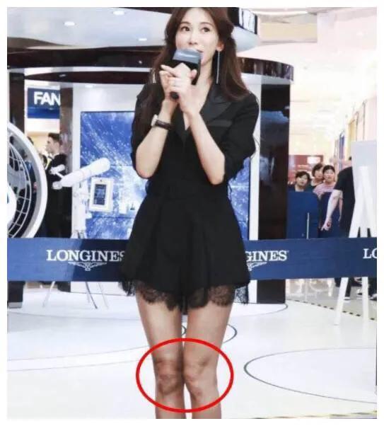 网友看到林志玲的膝盖出卖了你