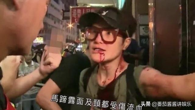 曾遭黑衣人围殴“香港最丑女星”马蹄露，再发声力挺政府抗疫举措
