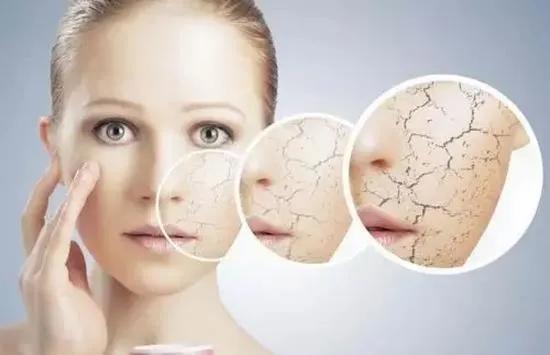 唯诺雅告诉你：肌肤紧致的状态，才是乘风破浪的自信