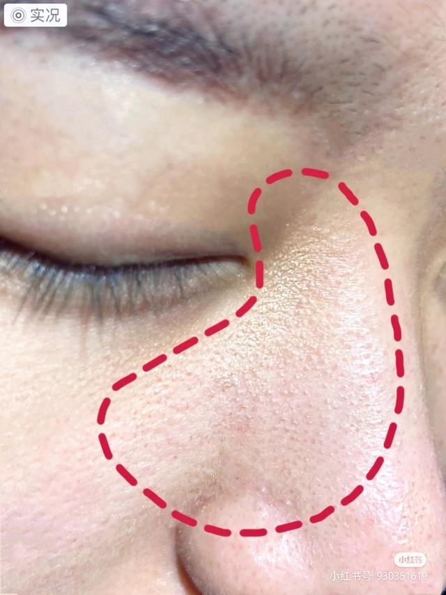 夏日如何养出"白煮蛋"好皮肤，跟我学会这几招，你就是发光小仙女