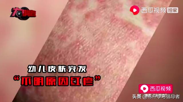 “大头娃娃”阴霾12年不散，别让三聚氰胺的噩梦卷土重来
