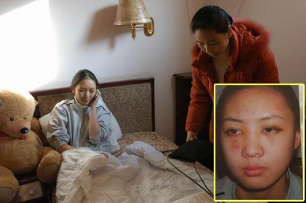 曾被张默打成重伤，遭雪藏5年的童瑶，今捡漏佟丽娅终成人生赢家