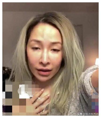 萧亚轩的脸终于恢复正常，曾被质疑过度改造像“巫婆”