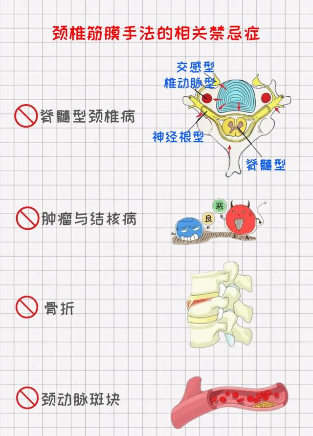 一图读懂｜为什么颈椎手法治疗前一定要拍片子？