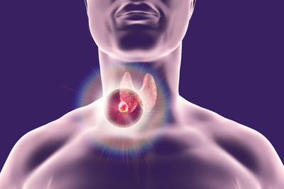 甲状腺肿大怎么治疗？这些方法或能帮大忙
