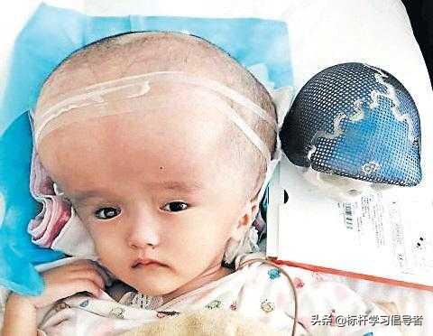 “大头娃娃”阴霾12年不散，别让三聚氰胺的噩梦卷土重来
