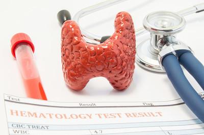甲状腺肿大怎么治疗？这些方法或能帮大忙