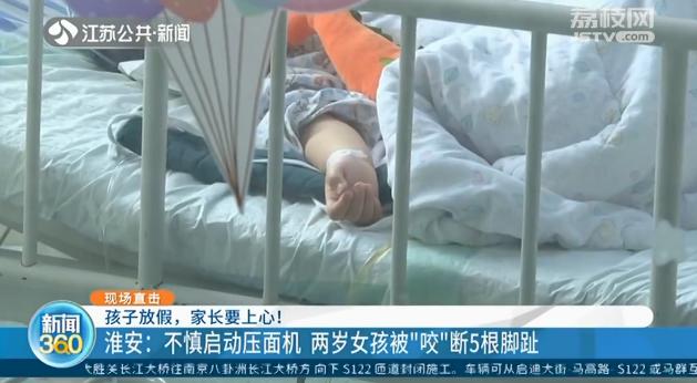 不慎启动压面机 两岁女孩瞬间被&ldquo;咬&rdquo;断5根脚趾