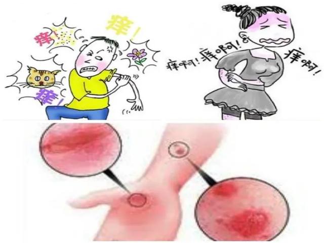 疫情“勤”洗手，洗出“主妇手”