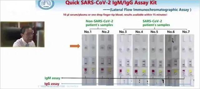 最新消息！新冠病毒繁殖时间可达37天！证实一致