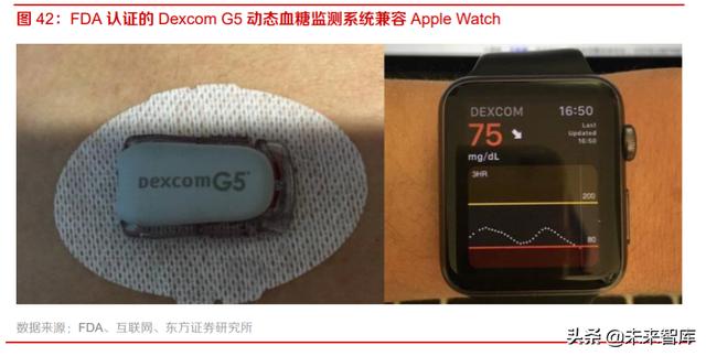 智能手表行业深度报告：持续创新，销量快速增长