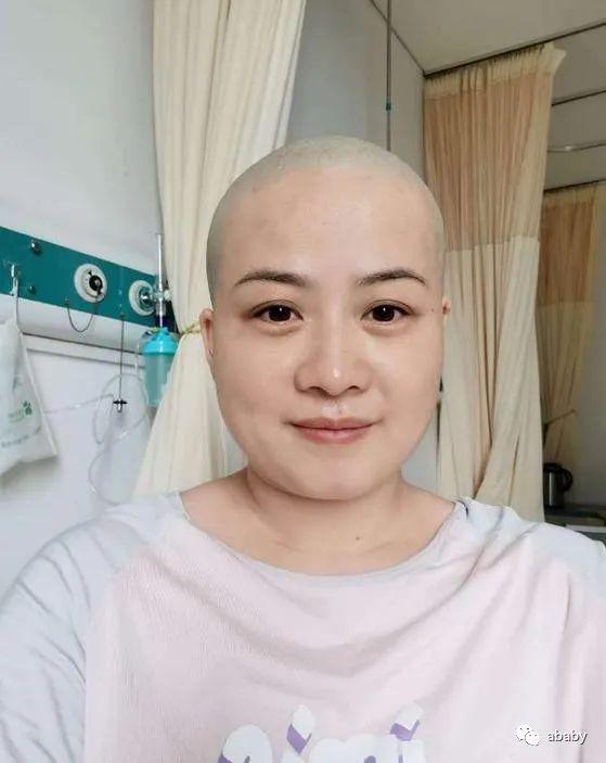 岳云鹏老婆生病住院头发掉光，粉丝捏把汗很担