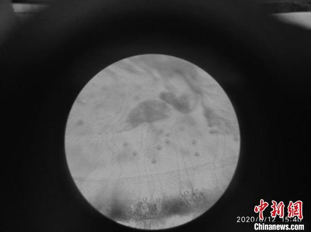 桃花@水中大熊猫桃花水母现身云南 有6亿年生存历史