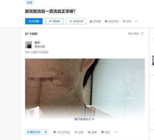 小伙拔牙10天后脑出血死亡，专家：他有白血病但自己不知道