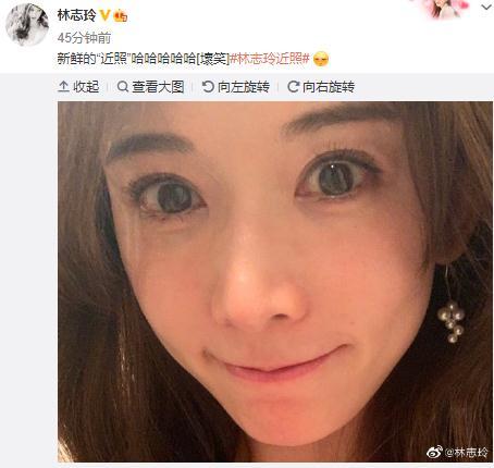 仙气|林志玲近照仙气不再，婚后脸越来越僵像极网红