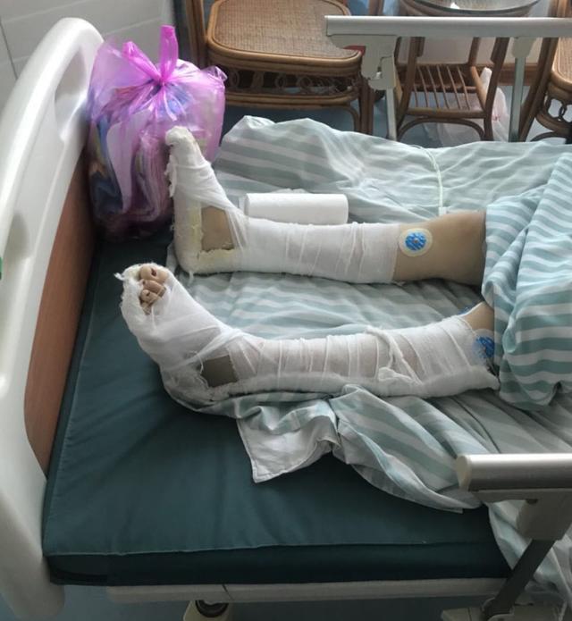 跳楼|女子不堪家暴跳楼双下肢截瘫 商丘市妇联介入