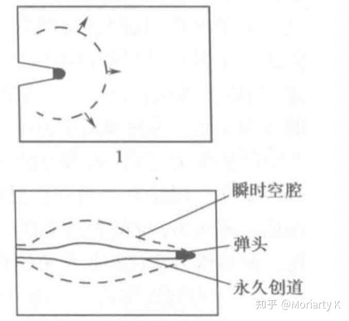 为什么中枪后要马上取出子弹？