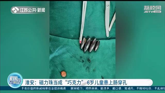 磁力珠当成“巧克力”！6岁男孩吞下四颗珠子导致肠穿孔