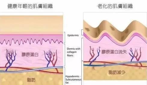 筋膜层的松弛,意味着胶原纤维的弹力不足,这张网状的皮筋整体失去弹性