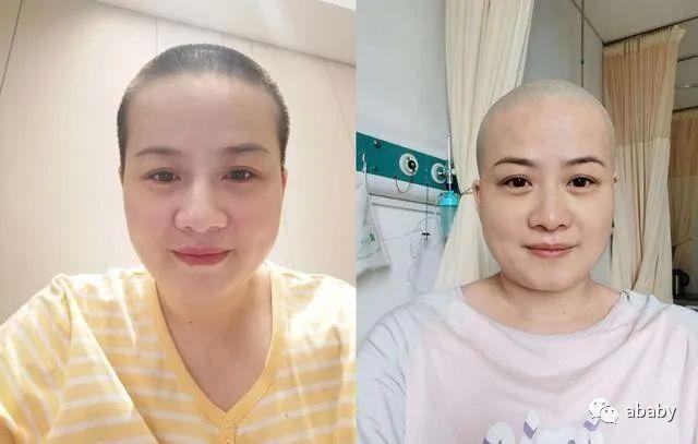 岳云鹏老婆生病住院头发掉光，粉丝捏把汗很担
