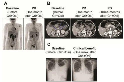 堪称第四代EGFR抑制剂——CH7233163。此次公布的是其临床前数据，体外肿瘤细胞株和小鼠实验均显示，CH72331
