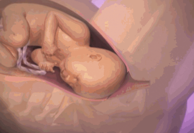 3D实图还原女性分娩全过程,没有一个妈妈能笑着看完
