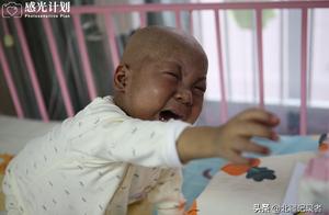 3 years old of Shuai Baobao are black be like charcoal, the skin wants exuviate, lachrymal character