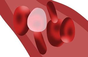 Triglyceride is exorbitant, to health He Ying ring