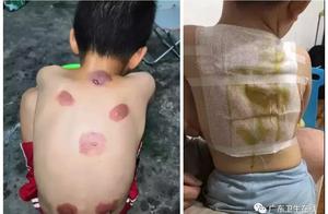 Be aching! 92 children by burnable! Stick three fi