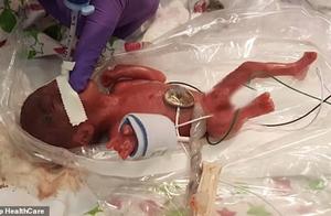 Slink 240 grams resemble 5 months weight apple, the whole world is the smallest darling survives smo