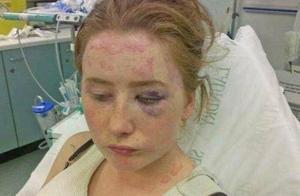 The skin when the woman is 16 years old resembles 