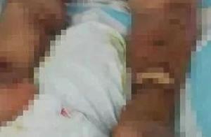 Edible of Fujian much person this kind of seafood is toxic! Somebody is not treated die! Official ca