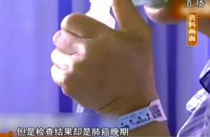 Doubt of man arm pang is like epileptic fit hospital to check is lung cancer unexpectedly terminal