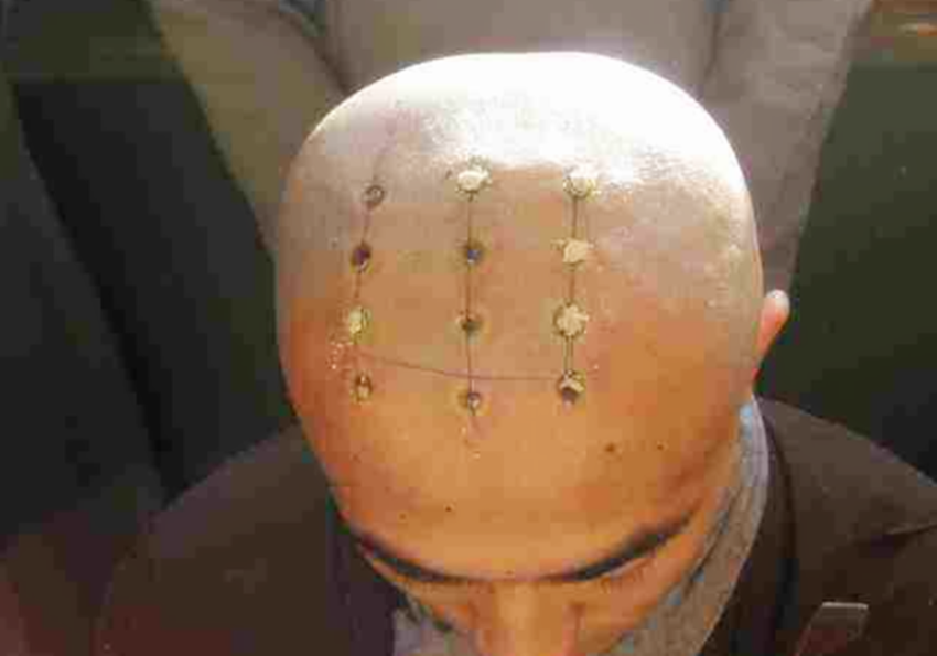 和尚从什么时候开始烧“戒疤”？