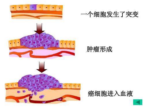 心脏为什么会成为癌细胞禁地