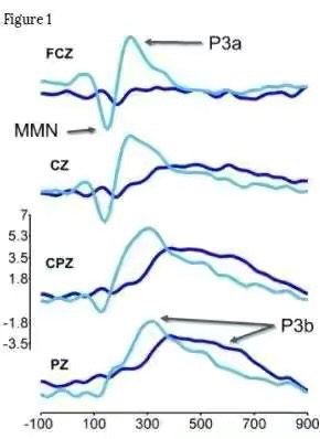 死亡瞬间或仍可感知声音，临终告别需谨言慎行