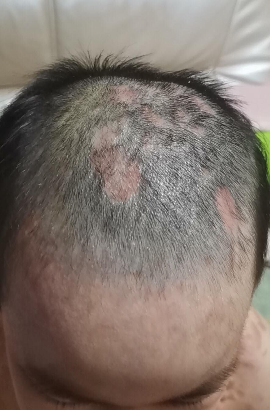 6岁女童被"打断"的童年:"爸爸"告诉我，说了就死定了