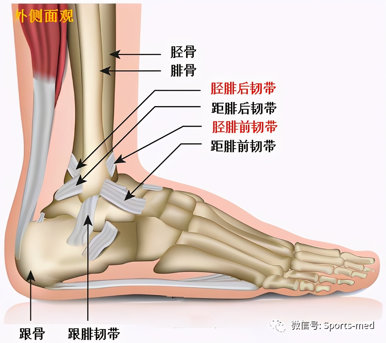 踝关节慢性疼痛警惕踝关节撞击综合征