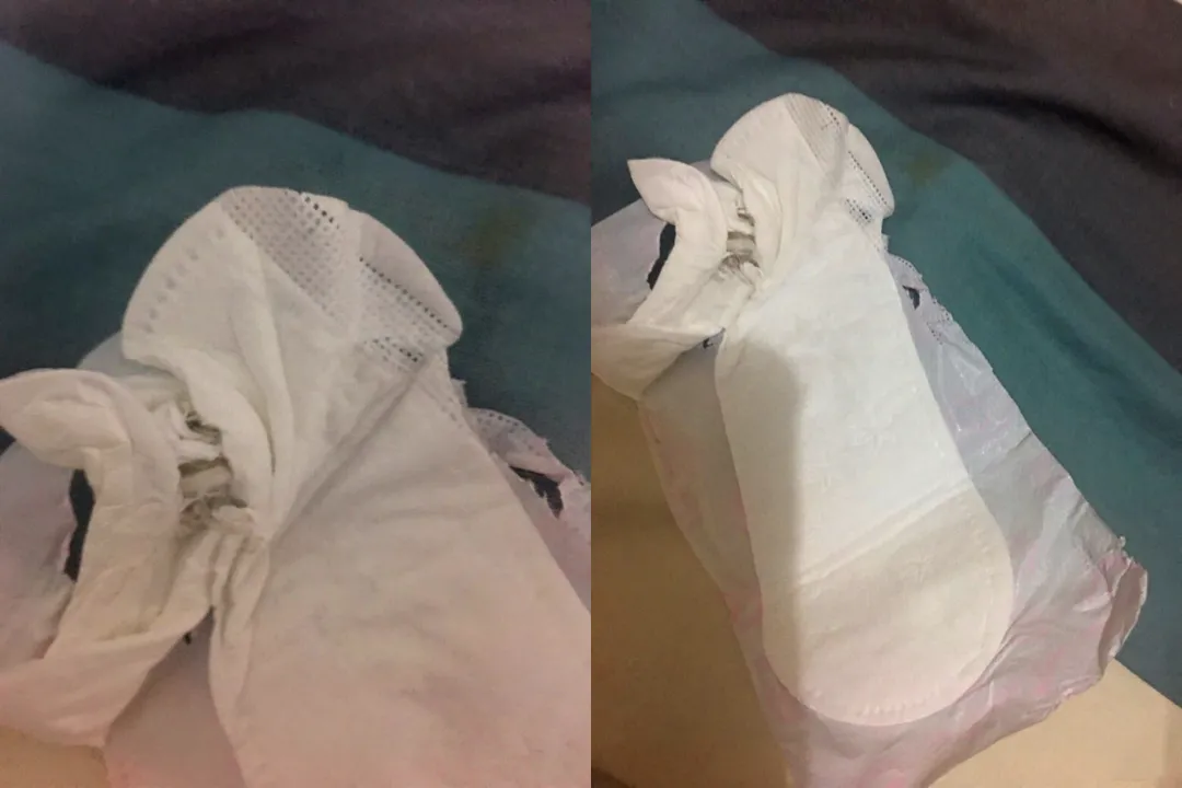结果发现有一只苍蝇夹在卫生巾夹层中,受到惊吓的王小姐第一时间联系