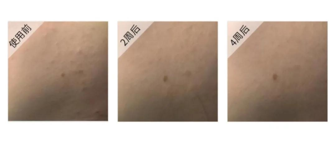 3天不洗头不油、吃零食还不发胖...这些好事真的有吗?